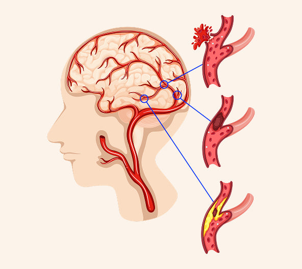 Think of your brain like a lamp on low power.